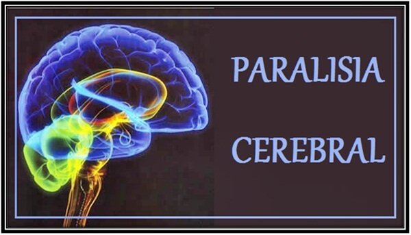 Paralisia-cerebral-por-que-acomete-crianças?